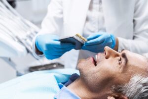 Affordable Dental Crown in St. Clair, Toronto