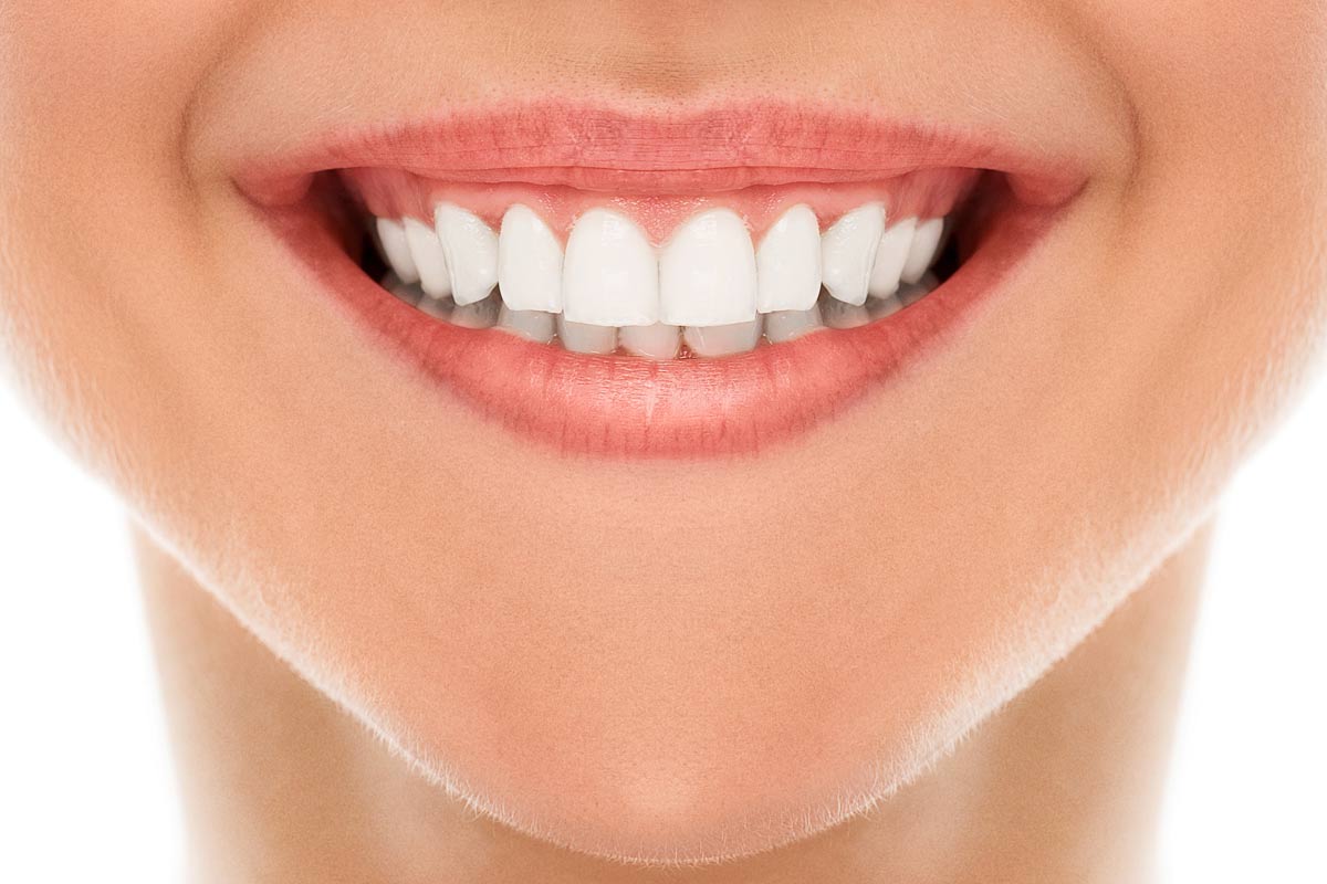 Affordable Teeth Whitening in Richmond Hill, Toronto