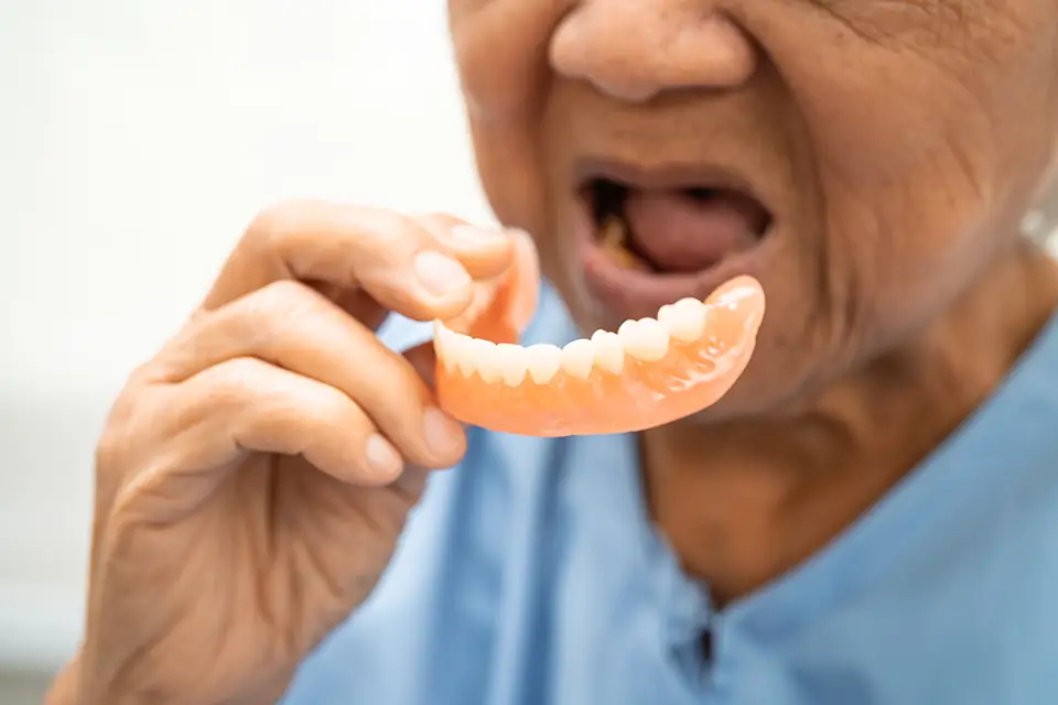 The Advantages of Dental Implant-Supported Dentures