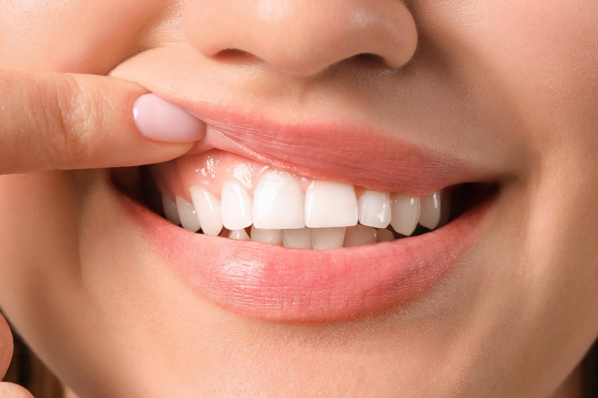 The Best Gum Disease Treatment in Richmond Hill, Toronto