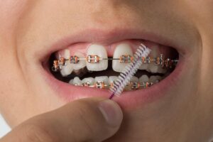 Affordable Oral Hygiene in Richmond Hill, Toronto