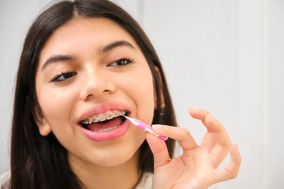 10 Ways to Keep Your Oral Hygiene While Wearing Braces