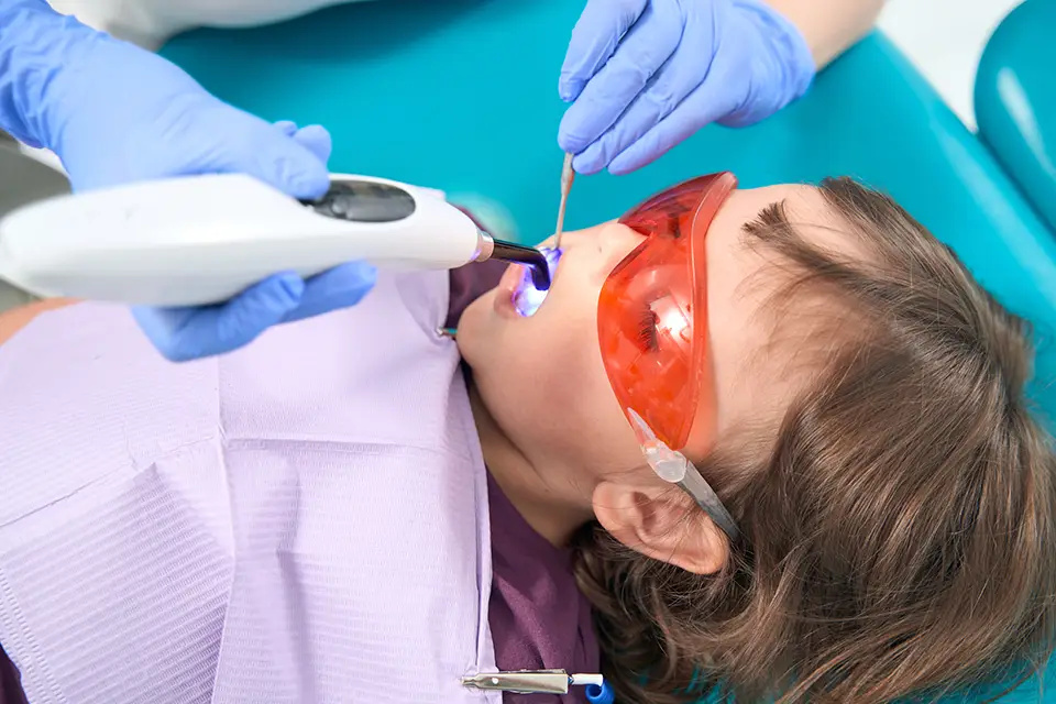 What Are Dental Sealants?