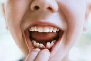 Children's Baby Teeth