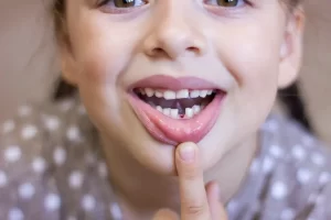 5 Tips to Handle a Loose Tooth for Parents and Children