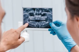 6 Important Reasons Why Dental X-Rays Are Crucial