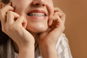 Addressing Common Orthodontic Issues and Their Solutions at Smile Dental, St. Clair, Toronto