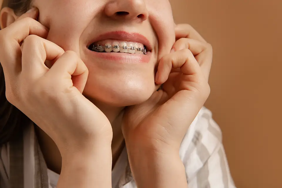 Addressing Common Orthodontic Issues and Their Solutions at Smile Dental, St. Clair, Toronto
