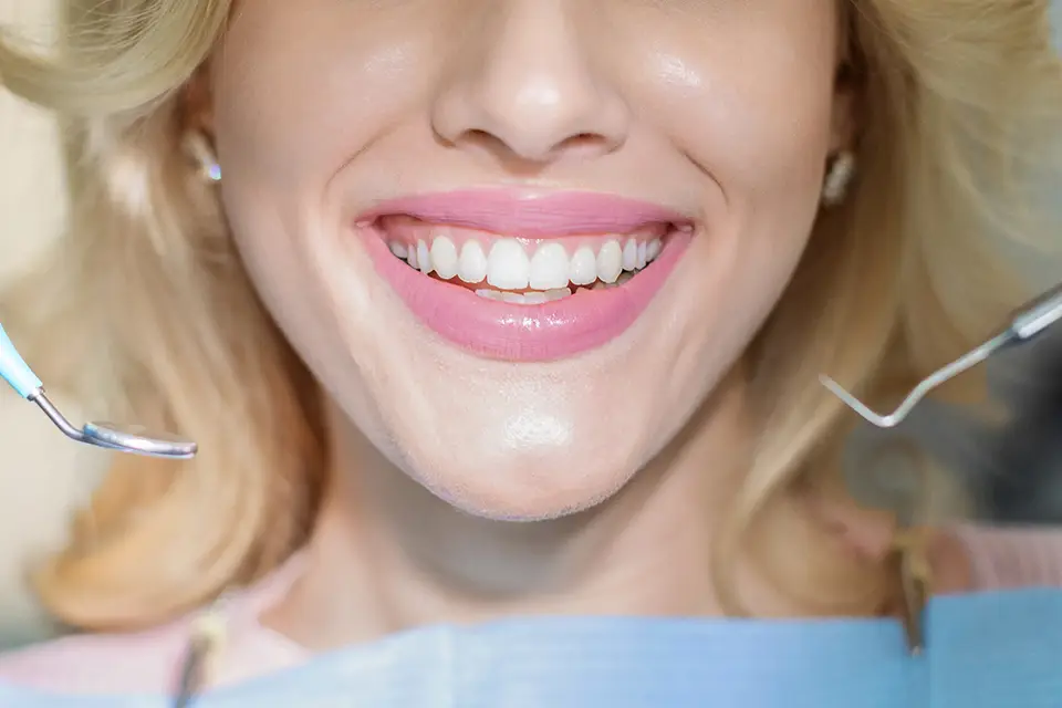 Is Teeth Whitening Safe? A Comprehensive Guide by Smile Dental in St. Clair, Toronto