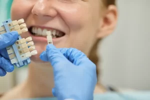 What Are Dental Veneers: Procedure, Benefits, and Costs