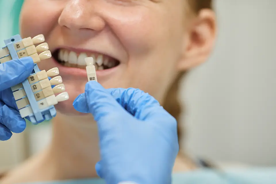 What Are Dental Veneers: Procedure, Benefits, and Costs