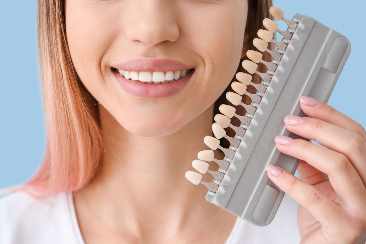 Affordable Porcelain Veneers and Composite Veneers in Toronto