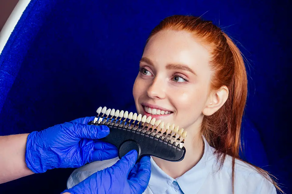 Can You Whiten Dental Veneers? A Guide to Maintaining That Perfect Smile