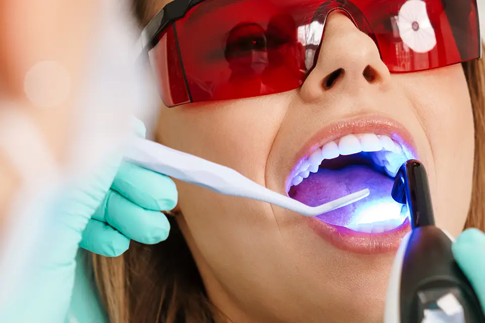 Unveiling the Truth: Do Dental Cleanings Whiten Teeth?