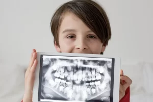 The Importance and Safety of Pediatric Dental X-Rays at Smile Dental in St. Clair, Toronto