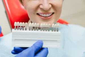 Full Mouth Implants: Options for Complete Tooth Replacement at Smile Dental, St. Clair, Toronto