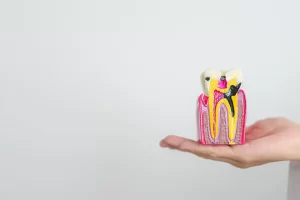 Single-Tooth Replacement: Restoring Your Smile with Dental Bridges
