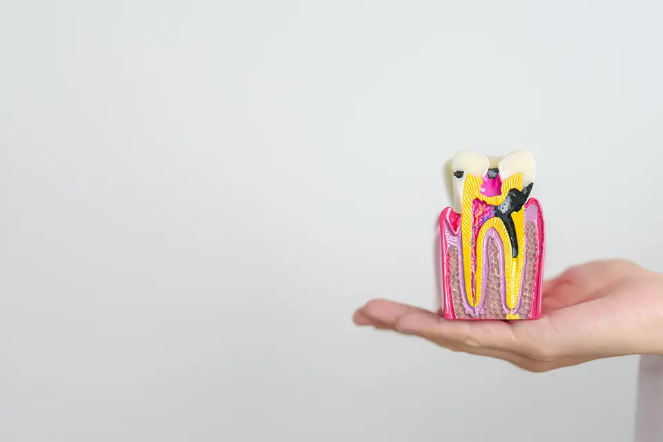 Single-Tooth Replacement: Restoring Your Smile with Dental Bridges