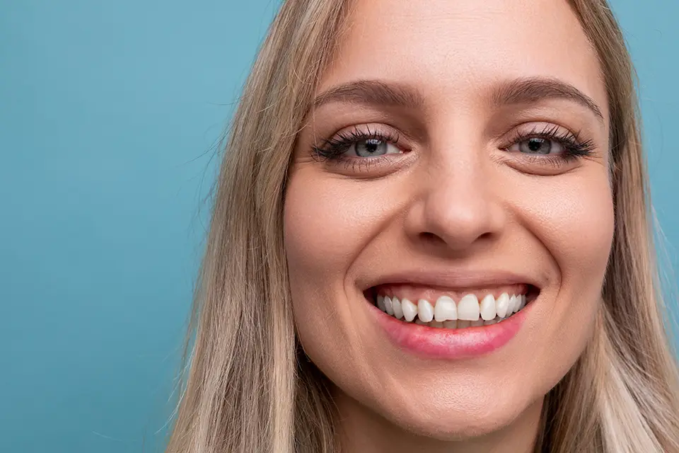 Can I Whiten Bonded Teeth? Managing Color Consistency with Smile Dental in St. Clair, Toronto