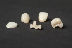 Dental Crown Alternatives: Exploring Your Options