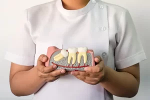 Impacted Wisdom Teeth: Understanding the Basics