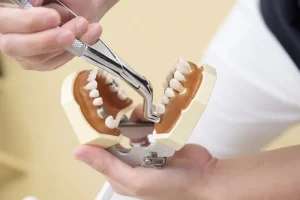 Wisdom Tooth Extraction