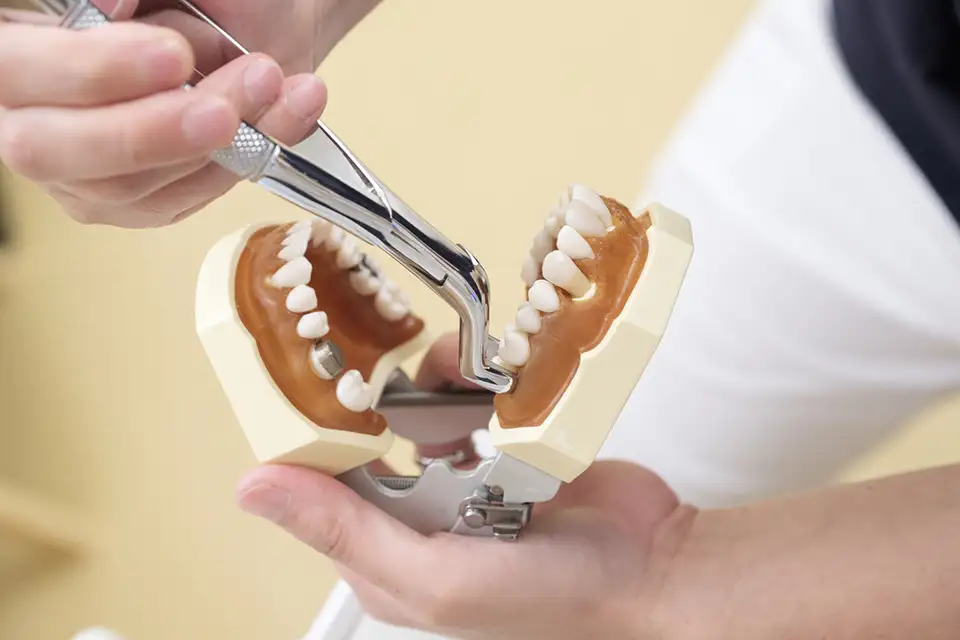 Wisdom Tooth Extraction