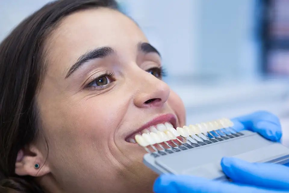 How Dental Veneers Address Dental Imperfections: A Solution from Smile Dental in St. Clair, Toronto