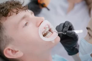 Orthodontics for Adults