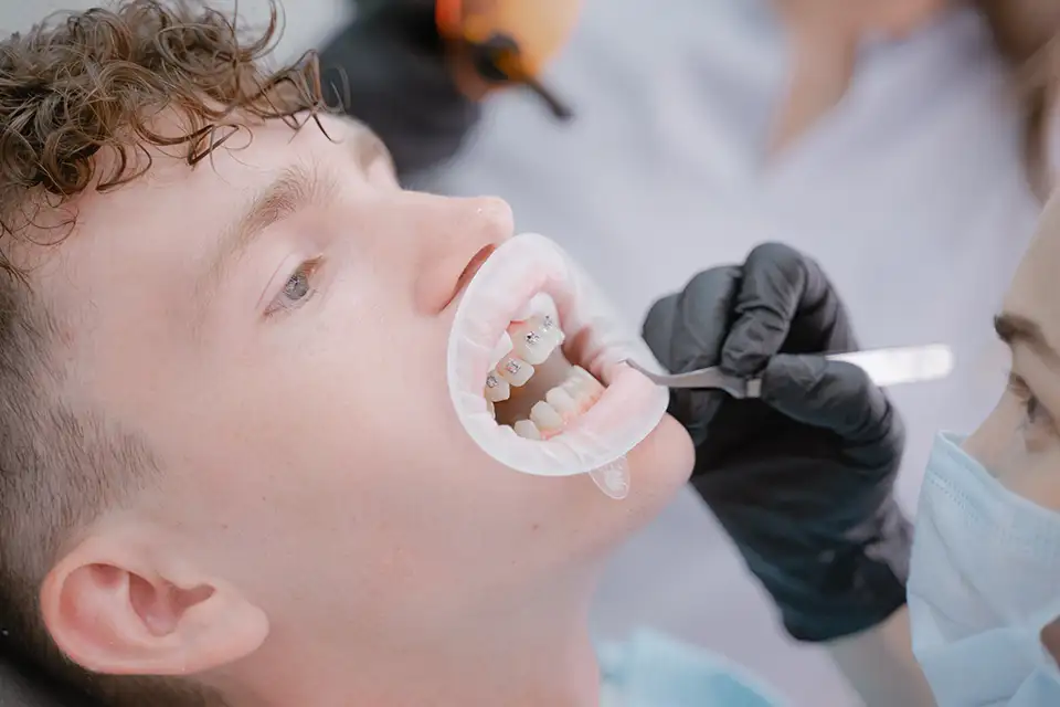 Orthodontics for Adults