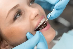 The Benefits and Process of Tooth-Coloured Fillings