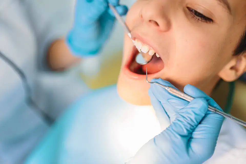 Understanding Dental Cavity Treatment: A Comprehensive Guide