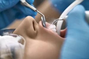 The Essential Guide to Teeth Cleaning Methods
