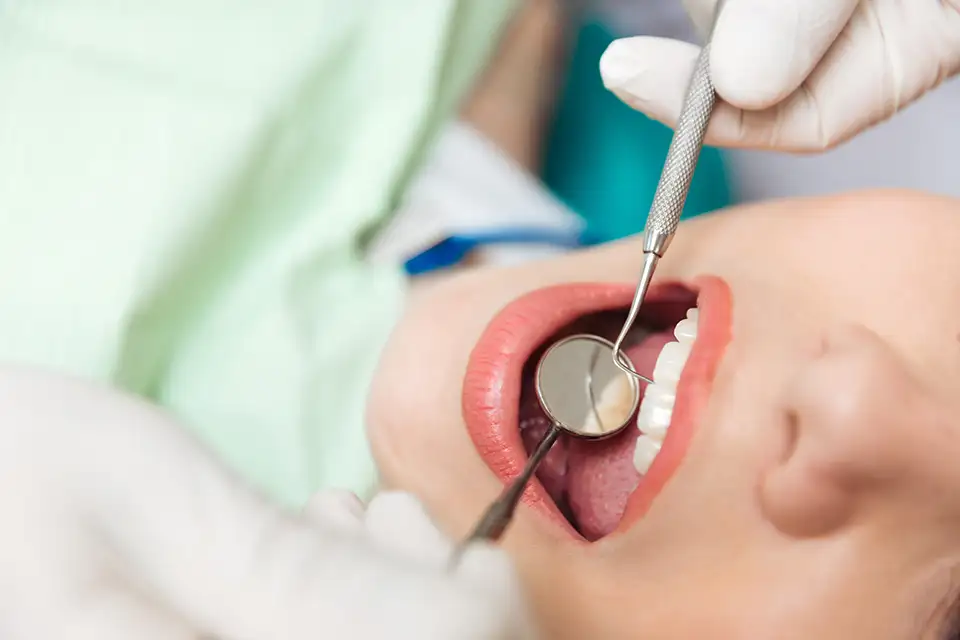 Maintenance and Care for Dental Fillings: Essential Tips for a Healthy Smile
