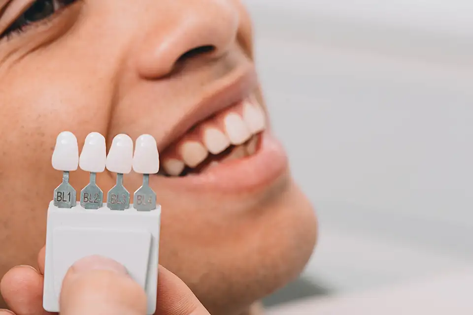 Types of Dental Veneers: A Comprehensive Guide