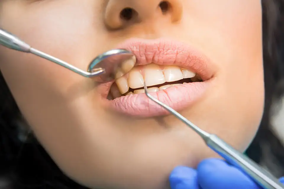 What is Pulp Infection Treatment?