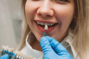 Risks and Benefits of Dental Veneers