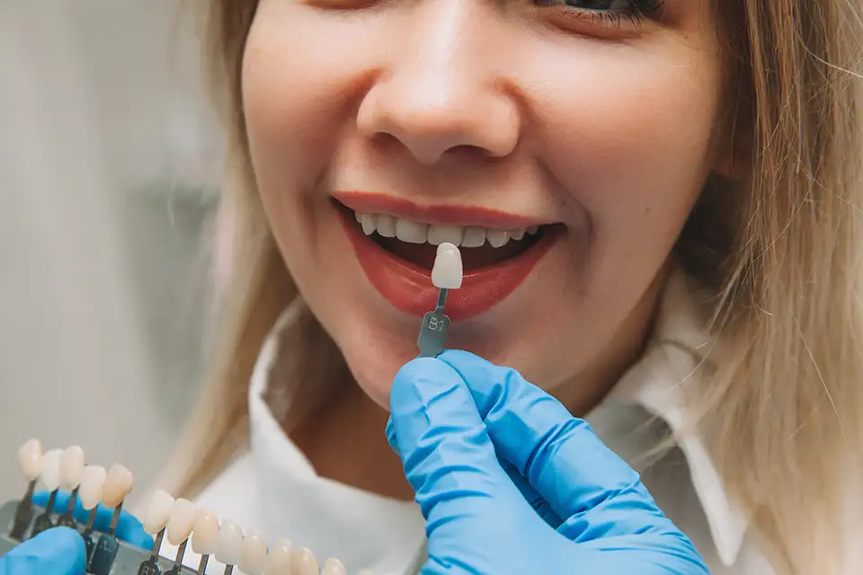 Risks and Benefits of Dental Veneers