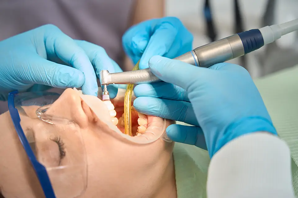 7 Signs You Need a Dental Filling