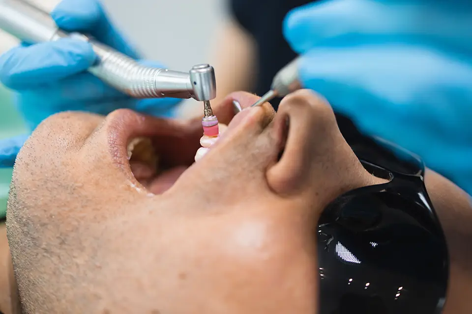 Difference Between Dental Cleaning and Deep Cleaning