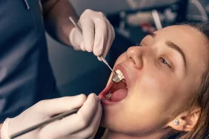 7 Essential Tips Before Dental Extraction