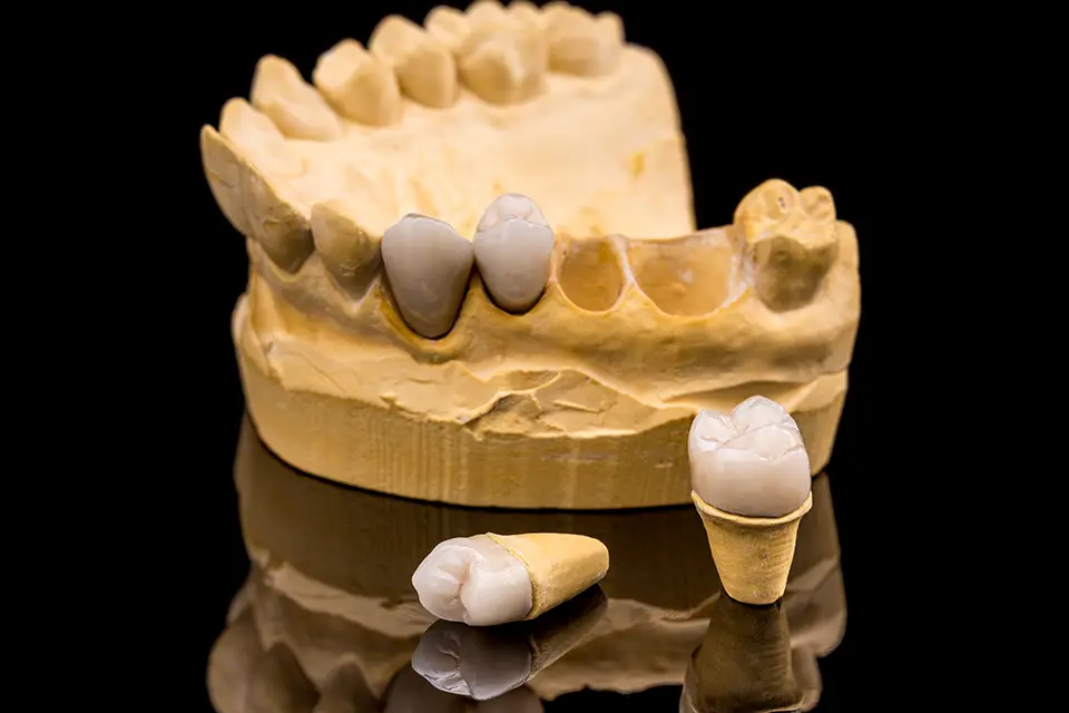 Understanding Dental Crown Materials: Which One is Right for You?