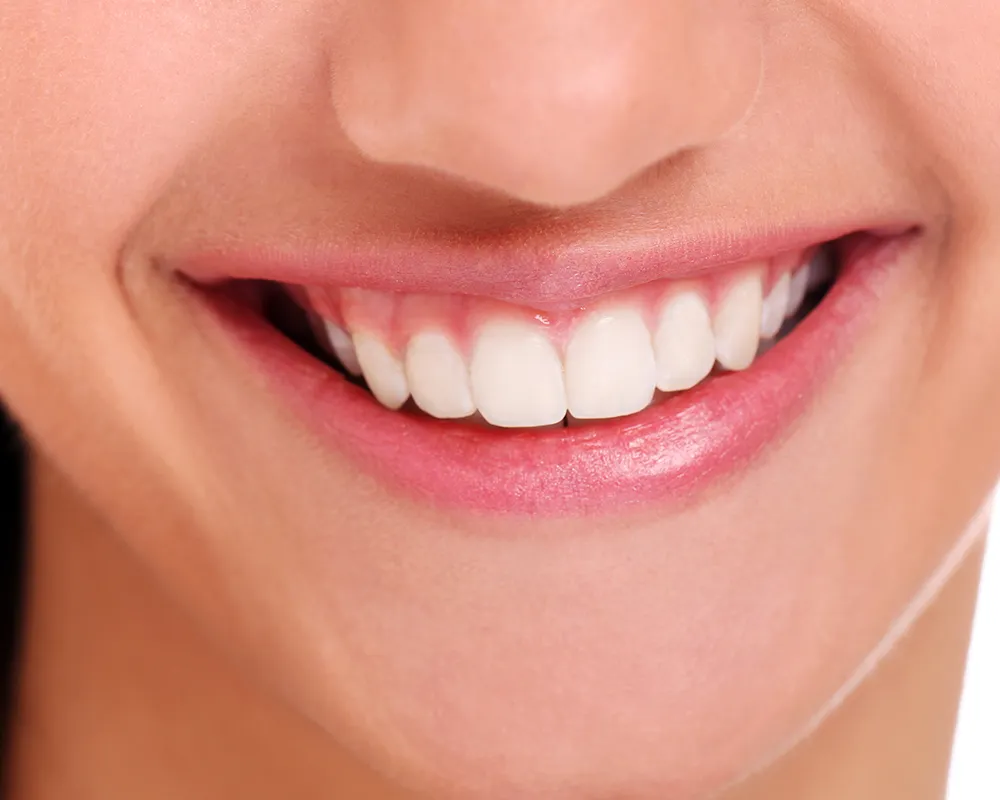 Dental Crowns and Bridges in Toronto