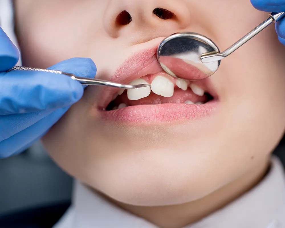 Kids Dentistry in Toronto