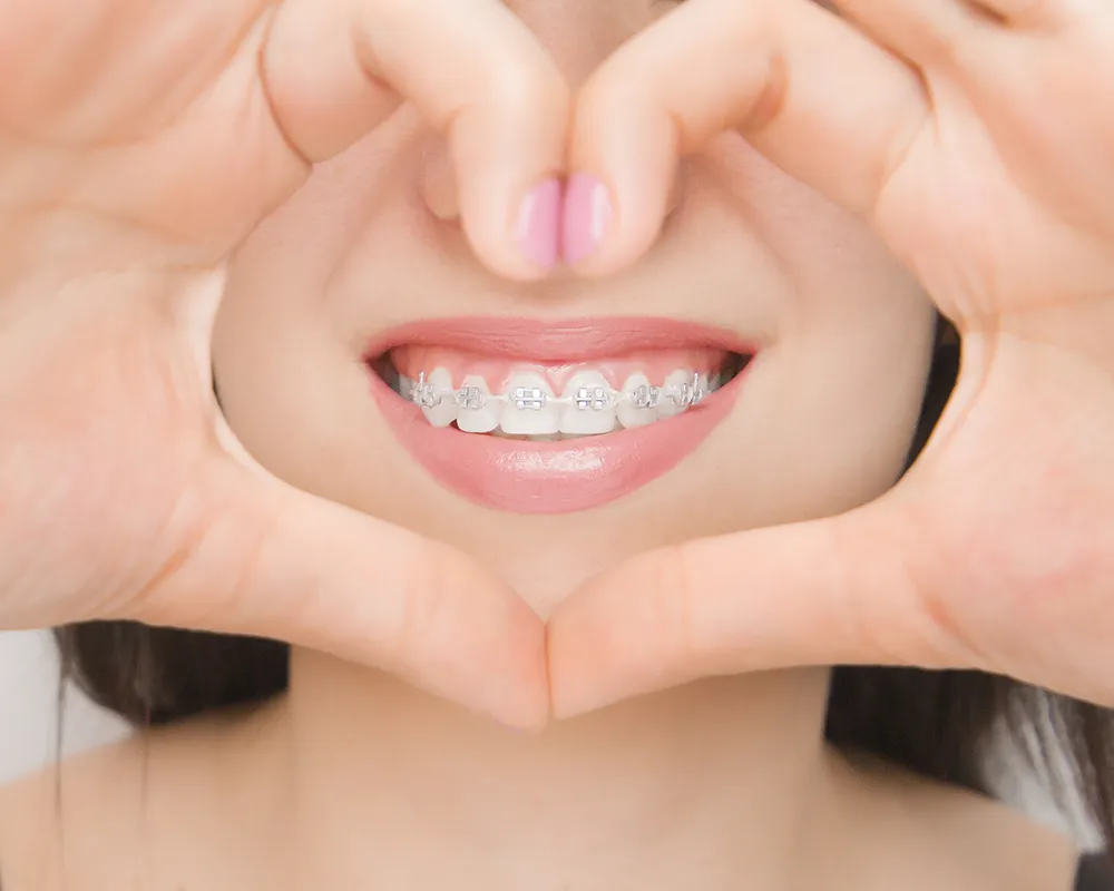 Best Orthodontics in Toronto