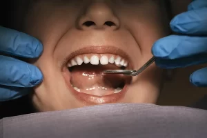 Metal vs. Composite Fillings: Which Is Right for You?