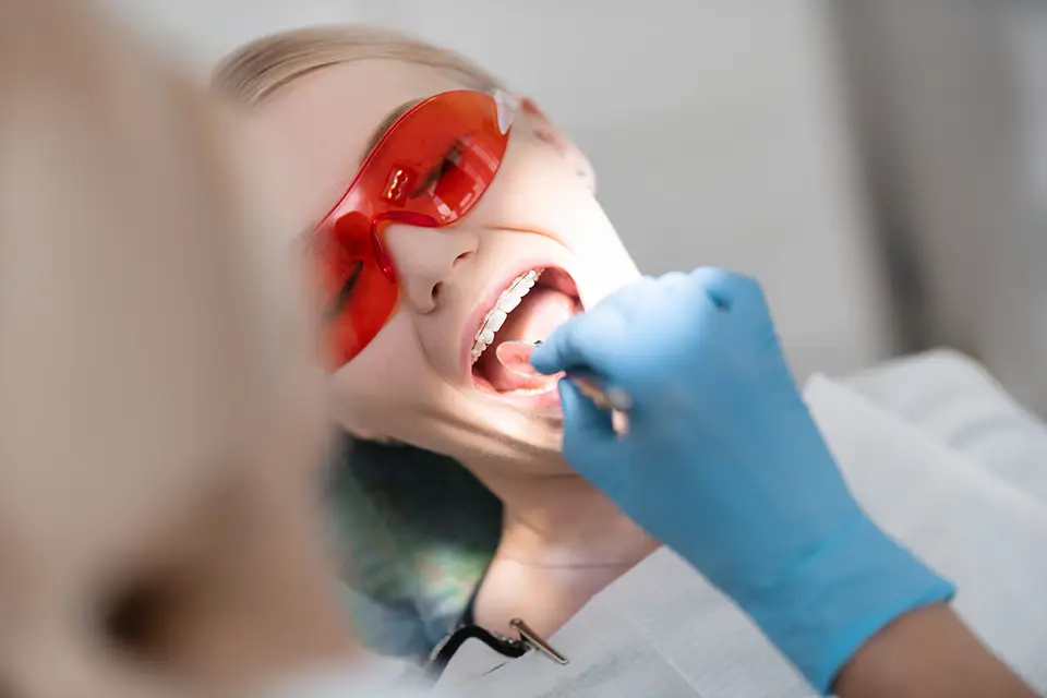 Types of Dental Fillings: A Comprehensive Guide