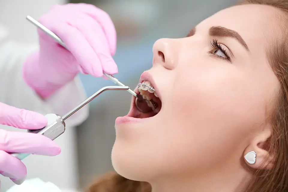 5 Benefits of Root Canal Over Extraction