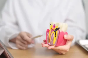 Preventing Root Canal Therapy: Essential Tips for a Healthy Smile