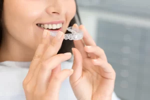 Clear Aligners: The Modern Solution for a Straighter Smile